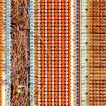 AI-Powered EpiPipeline4RD Enhances Epidemiology Research for 400M Rare Disease Patients