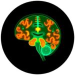 Machine Learning Enhances Lumbar Disc Degeneration Classification, Promises Personalized Treatment