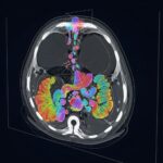 ProGiDiff Achieves High-Accuracy Medical Image Segmentation Using Natural Language Prompts
