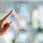 AI Simplifies Radiology Reports, Enhancing Comprehension by 100% in New Study