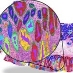 AI Study Reveals Cancer Diagnosis Tools Rely on Hidden Shortcuts, Not True Biology