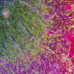 HKUST Develops PRET System Achieving 100% Accuracy in Colorectal Cancer Diagnosis