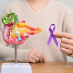 Mayo Clinic’s AI Tool REDMOD Detects Pancreatic Cancer Up to 3 Years Early